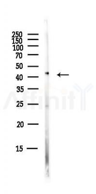 PAX4 Antibody - Western blot analysis of lysates from Hela cells(starvation,24h treatment), using PAX4 Antibody at 1/1000 dilution.
