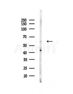 Cytochrome P450 4F12 Antibody - Western blot analysis of lysates from Hela cells(UV,30min treatment), using Cytochrome P450 4F12 Antibody at 1/1000 dilution.
