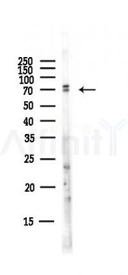Cytochrome P450 3A43 Antibody - Western blot analysis of lysates from Hela cells(starvation,24h treatment), using Cytochrome P450 3A43 Antibody at 1/1000 dilution.