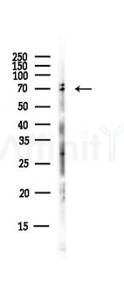 Cytochrome P450 3A43 Antibody - Western blot analysis of lysates from EC304 cells(heat-shock,45min treatment), using Cytochrome P450 3A43 Antibody at 1/1000 dilution.