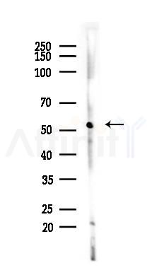 Cytochrome P450 3A4 Antibody - Western blot analysis of lysates from PC12 cells, using Cytochrome P450 3A4 Antibody at 1/1000 dilution.