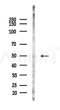 ING3 Antibody - Western blot analysis of lysates from Hela cells(LPS, 4h treatment), using ING3 Antibody at 1/1000 dilution.