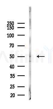 ING3 Antibody - Western blot analysis of lysates from LoVo cells(heat-shock,45min treatment), using ING3 Antibody at 1/1000 dilution.