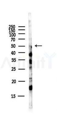 MKK7 Antibody - Western blot analysis of lysates from Hela cells(starvation,24h treatment), using MKK7 Antibody at 1/1000 dilution.