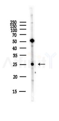 BAG2 Antibody - Western blot analysis of lysates from Hela cells(starvation,24h treatment), using BAG2 Antibody at 1/1000 dilution.