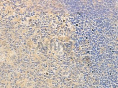 BAG2 Antibody - DF2650 at 1/100 staining human normal tonsil tissue by IHC-P.