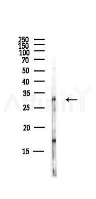 POMC Antibody - Western blot analysis of lysates from Hela cells(starvation,24h treatment), using POMC Antibody at 1/1000 dilution.