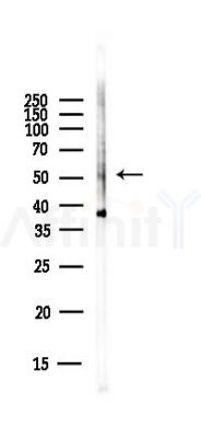 NEK2 Antibody - Western blot analysis of lysates from EC304 cells(heat-shock,45min treatment), using NEK2 Antibody at 1/1000 dilution.