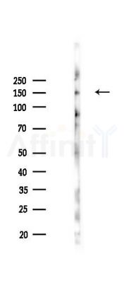 NRK Antibody - Western blot analysis of lysates from Hela cells(LPS,4h treatment), using NRK Antibody at 1/1000 dilution.