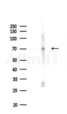 PCTK1 Antibody - Western blot analysis of lysates from EC304 cells(UV,30min treatment), using PCTK1 Antibody at 1/1000 dilution.