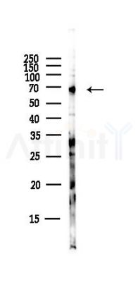 PRKG1 Antibody - Western blot analysis of lysates from Hela cells(starvation,24h treatment), using PRKG1 Antibody at 1/1000 dilution.
