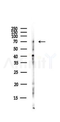 PRKG1 Antibody - Western blot analysis of lysates from EC304 cells(heat-shock,45min treatment), using PRKG1 Antibody at 1/1000 dilution.