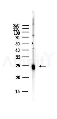 Peroxiredoxin 1 Antibody - Western blot analysis of lysates from Hela cells(starvation,24h treatment), using Peroxiredoxin 1 Antibody at 1/1000 dilution.