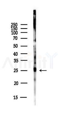 Peroxiredoxin 1 Antibody - Western blot analysis of lysates from EC304 cells(heat-shock,45min treatment), using Peroxiredoxin 1 Antibody at 1/1000 dilution.