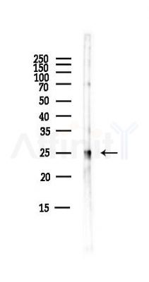 Peroxiredoxin 1 Antibody - Western blot analysis of lysates from Mouse brain, using Peroxiredoxin 1 Antibody at 1/1000 dilution.
