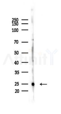 Peroxiredoxin 1 Antibody - Western blot analysis of lysates from PC12 cells, using Peroxiredoxin 1 Antibody at 1/1000 dilution.