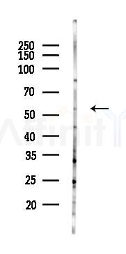 DRD5 Antibody - Western blot analysis of lysates from Mouse brain, using DRD5 Antibody at 1/1000 dilution.