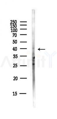 FPRL1 Antibody - Western blot analysis of lysates from Hela cells(starvation,24h treatment), using FPRL1 Antibody at 1/1000 dilution.