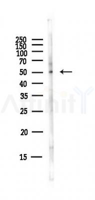 GPR20 Antibody - Western blot analysis of lysates from Hela cells(starvation,24h treatment), using GPR20 Antibody at 1/1000 dilution.