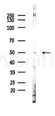 GPR22 Antibody - Western blot analysis of lysates from Hela cells(LPS, 4h treatment), using GPR22 Antibody at 1/1000 dilution.