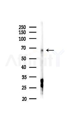 GPR37 Antibody - Western blot analysis of lysates from Hela cells(starvation,24h treatment), using GPR37 Antibody at 1/1000 dilution.