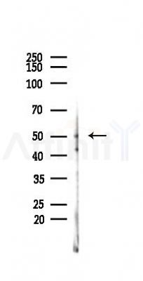 GPR39 Antibody - Western blot analysis of lysates from COLO205 cells(heat-shock,45min treatment), using GPR39 Antibody at 1/1000 dilution.