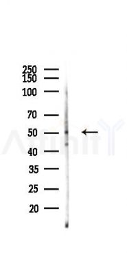 GPR39 Antibody - Western blot analysis of lysates from A375 cells(heat-shock,45min treatment), using GPR39 Antibody at 1/1000 dilution.