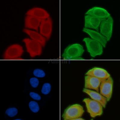 GPR4 Antibody - DF2744 staining Hela cells(45min of heat-shock) by IF/ICC.