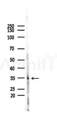 GPR84 Antibody - Western blot analysis of lysates from COLO205 cells(heat-shock,45min treatment), using GPR84 Antibody at 1/1000 dilution.