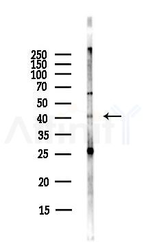 GPR86/GPR94 Antibody - Western blot analysis of lysates from Hela cells(starvation,24h treatment), using GPR86/GPR94 Antibody at 1/1000 dilution.