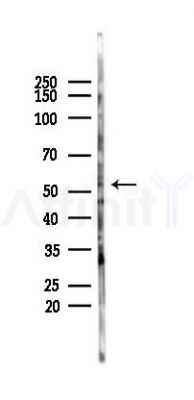 GPR89A Antibody - Western blot analysis of lysates from COLO205 cells(heat-shock,45min treatment), using GPR89A Antibody at 1/1000 dilution.