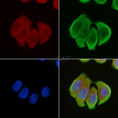 CXCR2 Antibody - DF2783 staining Hela cells(30min of UV treatment) by IF/ICC.