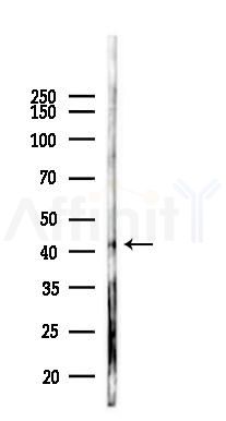 CXCR2 Antibody - Western blot analysis of lysates from Hela cells(starvation,24h treatment), using CXCR2 Antibody at 1/1000 dilution.