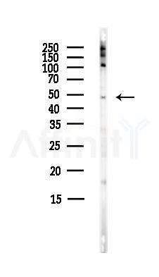 CCKBR Antibody - Western blot analysis of lysates from HepG2 cells(heat-shock,45min treatment), using CCKBR Antibody at 1/1000 dilution.