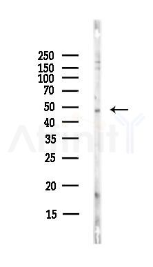 CCKBR Antibody - Western blot analysis of lysates from Hela cells(starvation,24h treatment), using CCKBR Antibody at 1/1000 dilution.