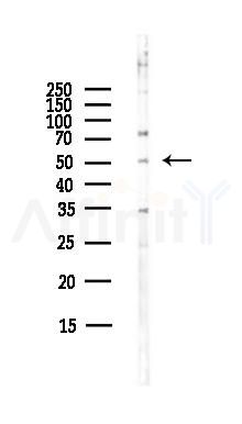 GPR39 Antibody - Western blot analysis of lysates from HepG2 cells(heat-shock,45min treatment), using GPR39 Antibody at 1/1000 dilution.