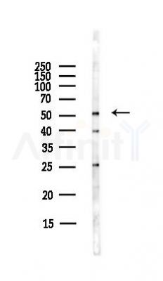 GPR39 Antibody - Western blot analysis of lysates from Hela cells(starvation,24h treatment), using GPR39 Antibody at 1/1000 dilution.