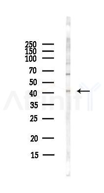 GPR45 Antibody - Western blot analysis of lysates from Hela cells(starvation,24h treatment), using GPR45 Antibody at 1/1000 dilution.
