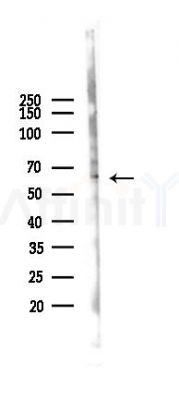 GPR97 Antibody - Western blot analysis of lysates from A375 cells(heat-shock,45min treatment), using GPR97 Antibody at 1/1000 dilution.