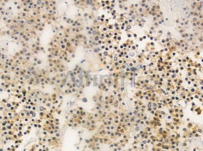 OR4F3/4F21 Antibody - DF2827 at 1/100 staining human pituitary adenoma by IHC-P.
