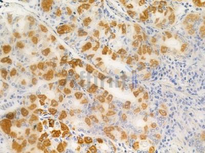 OR4F3/4F21 Antibody - DF2827 at 1/100 staining human normal gastric tissue by IHC-P.