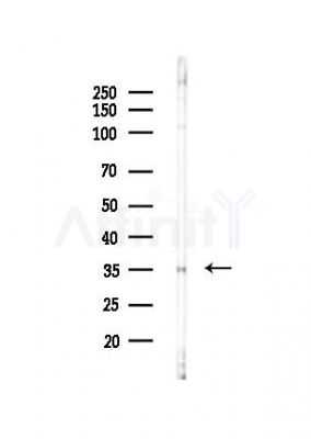 OR2T6 Antibody - Western blot analysis of lysates from PC12 cells(UV,30min treatment), using OR2T6 Antibody at 1/1000 dilution.