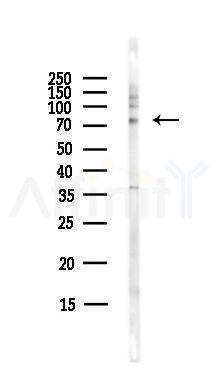 Bcl6 Antibody - Western blot analysis of lysates from HepG2 cells(heat-shock,45min treatment), using Bcl6 Antibody at 1/1000 dilution.
