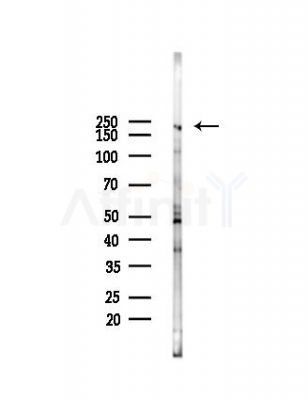 Brd4 Antibody - Western blot analysis of lysates from A2780 cells, using Brd4 Antibody at 1/1000 dilution.