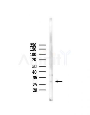 C10orf63 Antibody - Western blot analysis of lysates from Mouse liver, using C10orf63 Antibody at 1/1000 dilution.