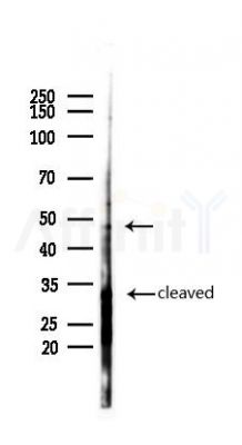Caspase 2 Antibody - Western blot analysis of lysates from COLO205 cells(heat-shock,45min treatment), using Caspase 2 Antibody at 1/1000 dilution.