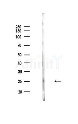 Rab9 Antibody - Western blot analysis of lysates from Mouse lung, using Rab9 Antibody at 1/1000 dilution.