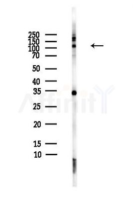 RNF20 Antibody - Western blot analysis of lysates from HepG2 cells(heat-shock,45min treatment), using RNF20 Antibody at 1/1000 dilution.