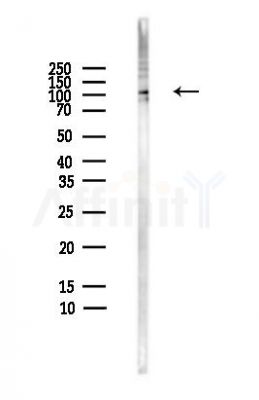 TLR9 Antibody - Western blot analysis of lysates from HepG2 cells(heat-shock,45min treatment), using TLR9 Antibody at 1/1000 dilution.