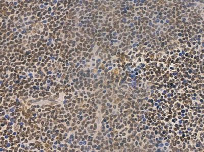 Phospho-RSK2 (Tyr529) Antibody - DF2976 at 1/100 staining human normal tonsil tissue by IHC-P.